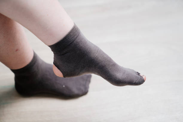 istock old holey sock on the leg 1306318344