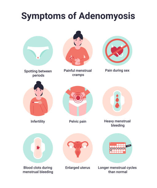 Set symptoms of adenomyosis Set symptoms of adenomyosis, endometriosis interna or adenomyometritis. Flat vector cartoon modern illustration. cervix pregnancy stock illustrations