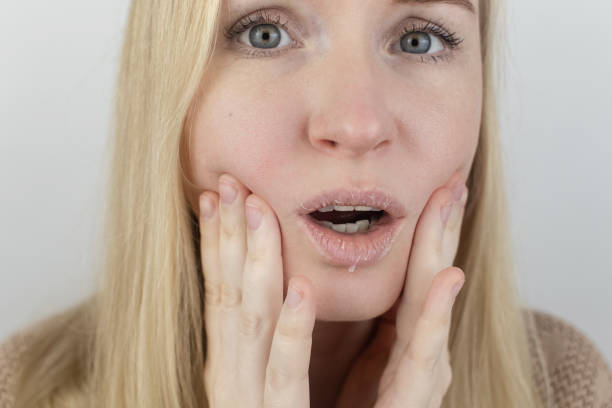 kobieta bada suchą skórę na ustach. peeling, ziarchiwanie, dyskomfort, wrażliwość skóry. pacjent na wizytę dermatologa lub kosmetologa. zbliżenie kawałków suchej skóry - human skin dry human face peeling zdjęcia i obrazy z banku zdjęć