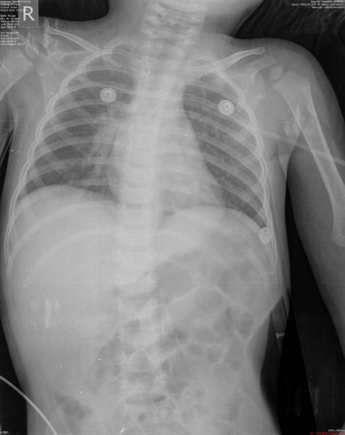 istock Chest xray imgages 1306535436