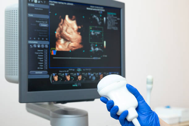 mano del médico con un escáner de ultrasonido en el fondo del monitor. - gynecologist gynecological examination ultrasound human pregnancy fotografías e imágenes de stock