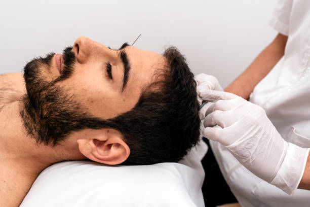 istock Man Receiving Acupuncture Treatment 1306713636