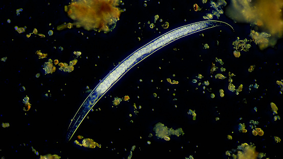 Nematode worm - Microscopic view
