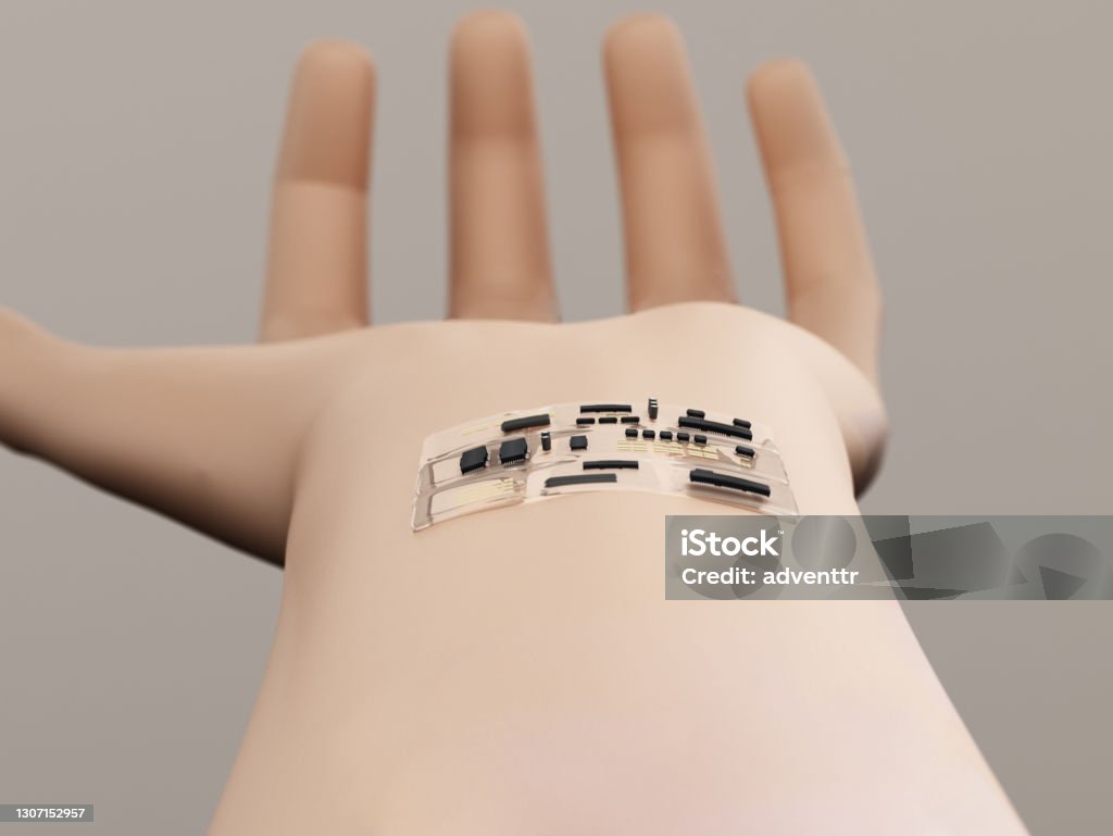 Group of computer chips and electronics on the wrist Group of computer chips and electronics on the wrist. Skin Stock Photo