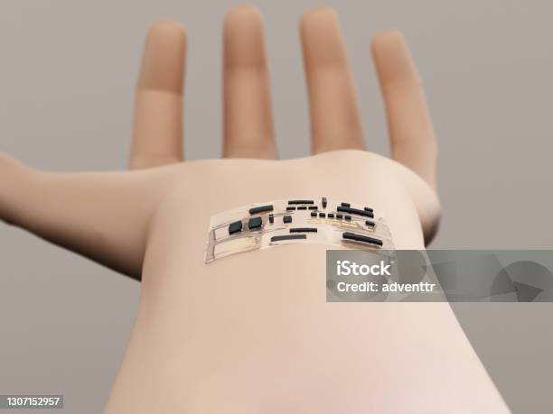 Group Of Computer Chips And Electronics On The Wrist Stock Photo - Download Image Now