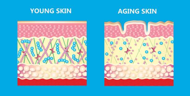 illustrazioni stock, clip art, cartoni animati e icone di tendenza di pelle più giovane e la pelle che invecchia. elastina e collagene. - fat layer