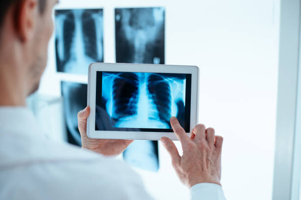 medico che esamina la radiografia di torace e costole su tablet digitale - human lung asthmatic x ray human internal organ foto e immagini stock