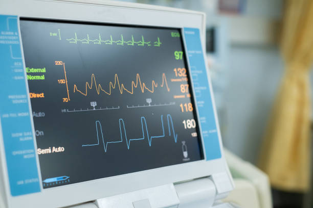 monitor ekg en máquina de bomba de globo intraaótico. equipo médico - human heart surveillance computer monitor pulse trace fotografías e imágenes de stock