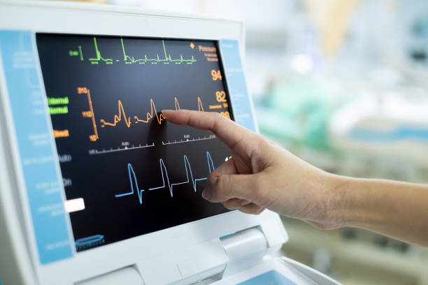 ekg-monitor in intraaorten ballonpumpenmaschine. medizinische geräte - human heart surveillance computer monitor pulse trace stock-fotos und bilder