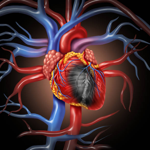 Heart Disease Anatomy Heart disease anatomy concept and cardiovascular illness from a human organ as a medical health care symbol in a 3D illustration style. heart surgery photos stock pictures, royalty-free photos & images