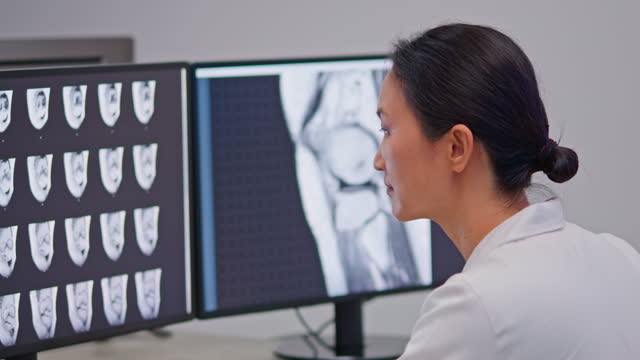Asian female doctor of radiology looking at the MRI images of the knee scan
