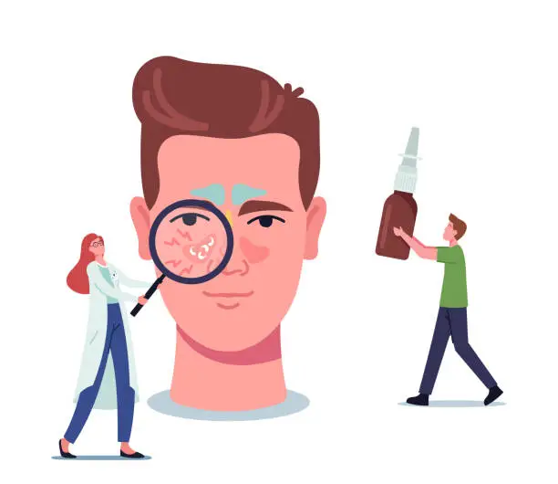 Vector illustration of Tiny Doctor Female Character with Magnifier Representing Sinusitis Disease on Huge Male Head, Man Bring Remedy for Nose