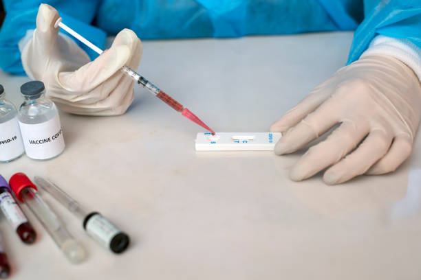 przyjrzyjmy się bliżej tej próbce - blood sample blood tube pathologist zdjęcia i obrazy z banku zdjęć