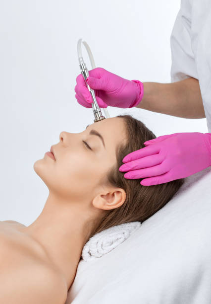 el cosmetólogo hace microdermabrasión del procedimiento en la cara contra el acné y las cabezas negras cerca de los ojos. cosmetología femenina en el salón de belleza. - dermatology dermabrasion surgery medical fotografías e imágenes de stock