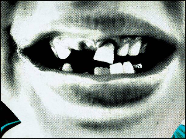boca de criança com dentes caindo - símbolo da anarquia - fotografias e filmes do acervo