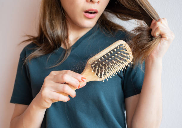 37 Woman With Hairbrush Is Suffering From Hair Loss Stock Photos, Pictures & Royalty-Free Images - iStock 37 Woman With Hairbrush Is Suffering From Hair Loss Stock Photos, Pictures & Royalty-Free Images - iStock