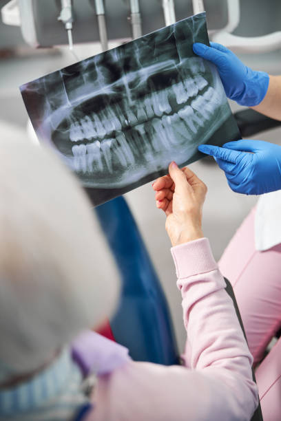 istock Pensioner having a look at teeth x-ray diagram 1307747029