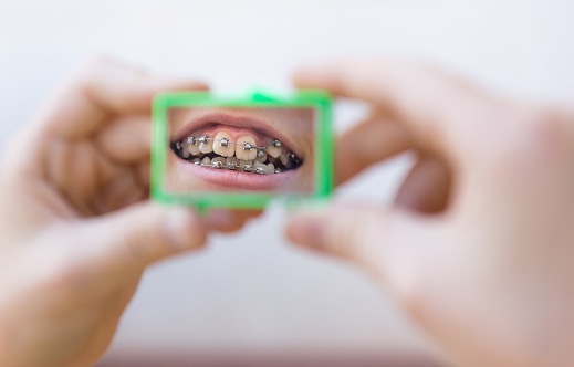 Manos sosteniendo un pequeño espejo que refleja la boca de una chica sonriente con ortodoncia photo