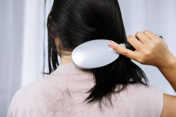 istock woman holding comb brushing her hair having problem with hair loss falling on back 1307915006
