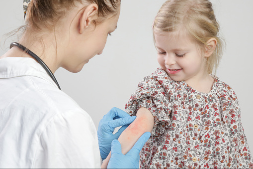 Doctor mirando eccema rojo y picazón en el brazo de la niña. Niña pequeña que sufre de dermatitis atópica. photo