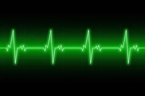 Vector illustration of Heartbeats cardiogram. EKG heart line. Green electrocardiogram background. Vector illustration.