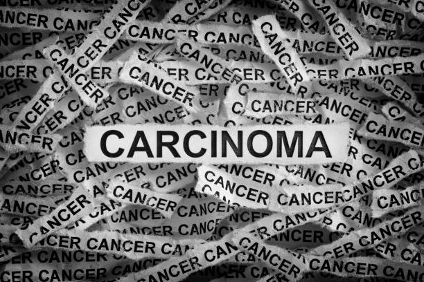 cancer. sönderslitna pappersbitar med orden carcinom och cancer. - basalcellscancer bildbanksfoton och bilder