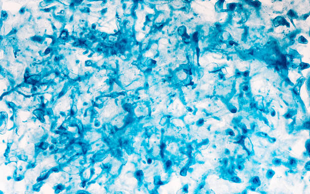 istock Abstract background in blue color, hand drawn acrylic painting, liquid ink technique 1308227009
