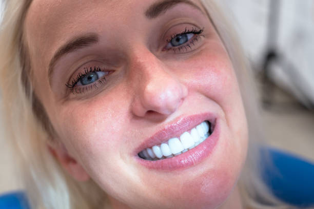 istock Female Patient Sitting On Dentist Chair 1308315075