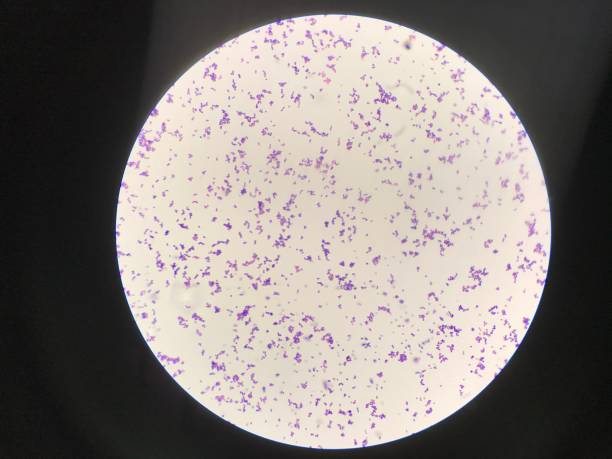 istock Bacteria cells in gram stain. 1308372897