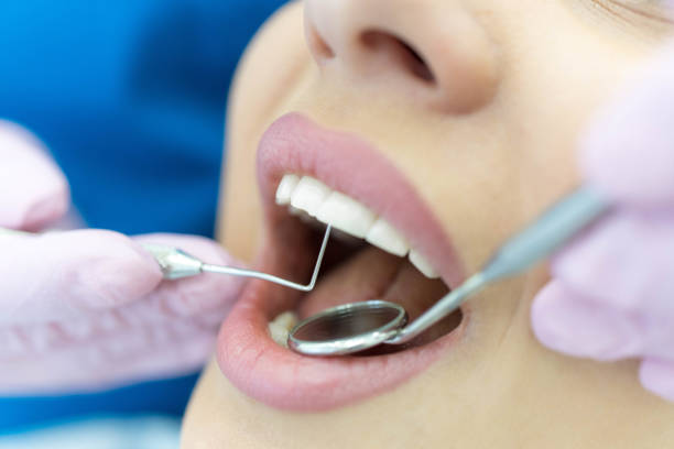 istock Woman having teeth examined at dentists 1308426066