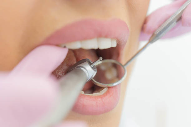 istock Woman having teeth examined at dentists 1308426358