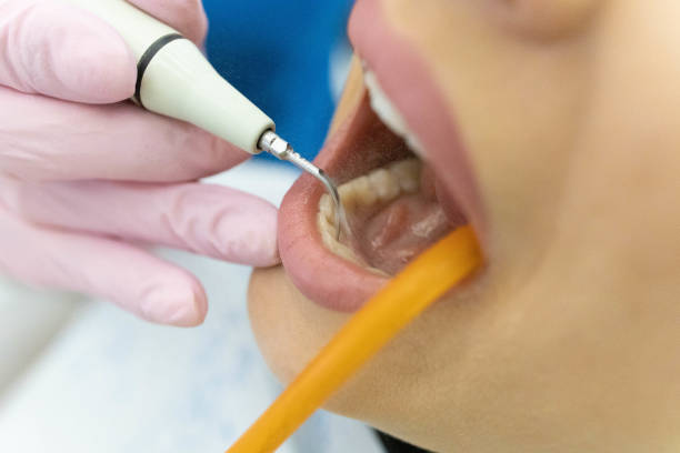 istock Woman having teeth examined at dentists 1308426755