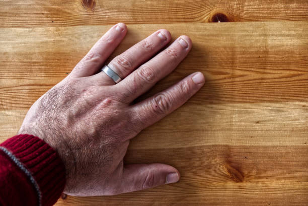 primer plano de la mano de un hombre con un trastorno obsesivo de la onicofgia compulsiva - nail biting biting fingernail obsessive fotografías e imágenes de stock
