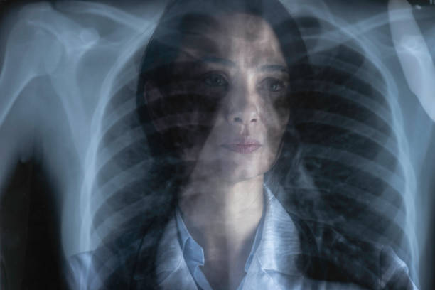 istock Female doctor looking at X-Ray 1308483646