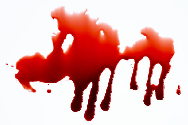 istock Drops of blood on white background. 1308522889