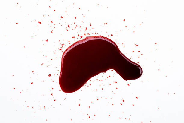 istock Drops of blood on white background. 1308522903