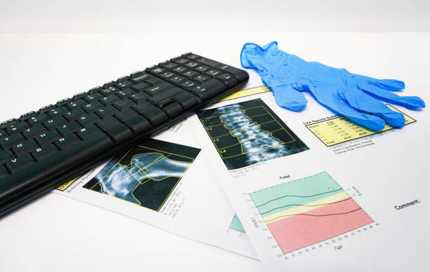istock Soft and blurry image: Bone Densitometer hip and spine report paper under keyboard .on the table doctor room white background 1308626037