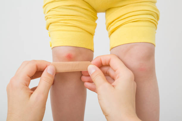 Young adult woman hands putting adhesive bandage on abrasion knee skin of toddler. Mother giving first aid. Closeup. Front view. Point of view shot. Isolated on light gray background. Young adult woman hands putting adhesive bandage on abrasion knee skin of toddler. Mother giving first aid. Closeup. Front view. Point of view shot. Isolated on light gray background. toddler hitting stock pictures, royalty-free photos & images