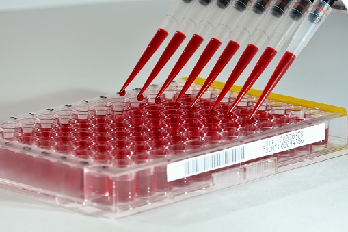 Fertility test in laboratory