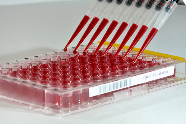 istock high throughput screening of covid-19 samples with a multichannel pipet in a microtiter plate large scale 1308793308