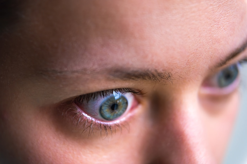 Macro retrato de perfil de primer plano de la joven se enfrenta a síntomas de hipertiroidismo de la enfermedad de Grave de oftalmopatía abultada ojos y edema proptosis photo