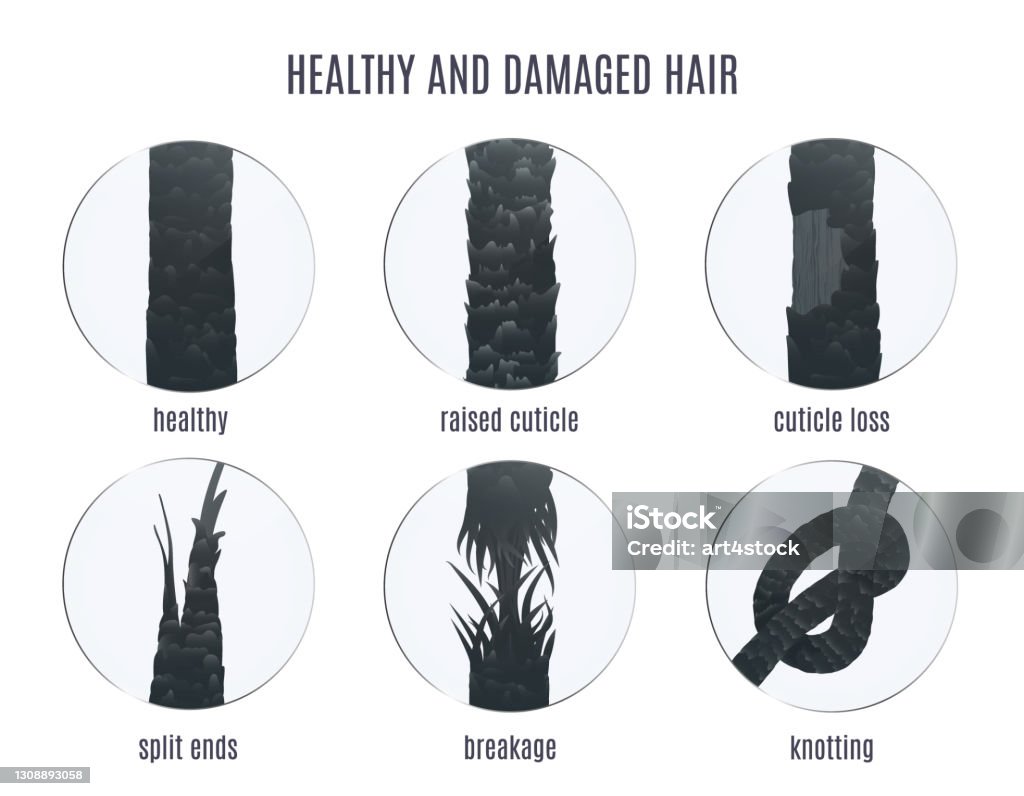 Big Set Of Magnified Follicles Showing Types Of Hair Damage Stock Illustration - Download Image Now - iStock Big Set Of Magnified Follicles Showing Types Of Hair Damage Stock Illustration - Download Image Now - iStock