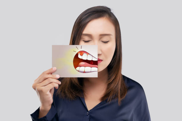 Periodontal Asian woman in the dark blue shirt holding a paper with the periodontal and gingivitis cartoon picture of his mouth against the gray background, Decayed tooth, The concept with healthcare gums and teeth abscess stock pictures, royalty-free photos & images