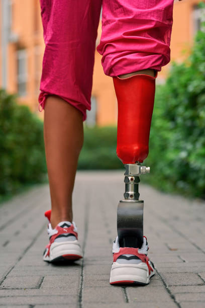 istock Disabled athlete person with leg prosthesis 1309210746
