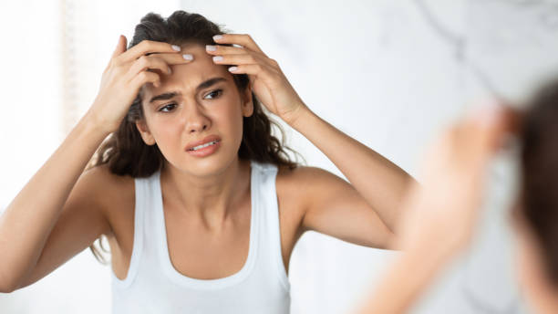 istock Sad Woman With Acne Issue Squeezing Pimple On Forehead Indoor 1309259851