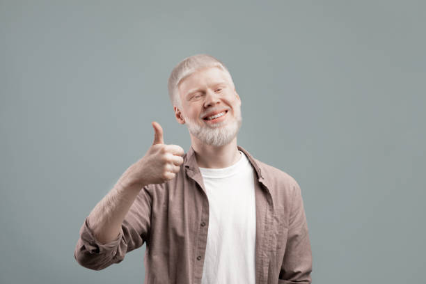 istock Happy albino guy showing thumb up gesture, approving or recommending something good, posing over grey background 1309262758