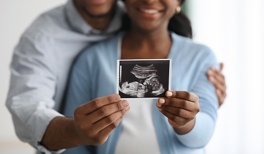 Closeup of black and white baby sonogram in hugging black couple hands, white background. Selective focus on ultrasound image, emotional african american family sharing their happiness, panorama