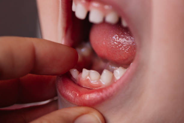 istock mother's close-up finger pulls loose baby tooth from baby's lower jaw 1309416565