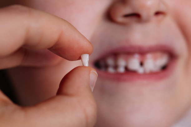 close-up thumb and index finger hold the fallen or removed baby tooth, front incisor with the blurred toothless mouth of the child in the background close-up the thumb and index finger hold the fallen or removed baby tooth, the front incisor with the blurred toothless mouth of the child in the background. rodent bedding stock pictures, royalty-free photos & images