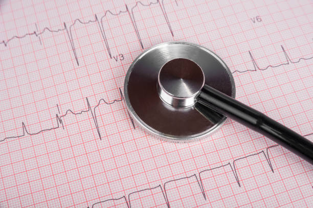 istock ECG graph with heart diagnose and stethoscope 1309551764